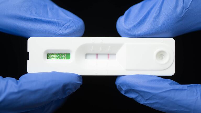Genau 399 Neuinfektionen mit dem Coronavirus hat das Gesundheitsamt seit Dienstag registriert. Genau 399 Neuinfektionen mit dem Coronavirus hat das Gesundheitsamt seit Dienstag registriert.