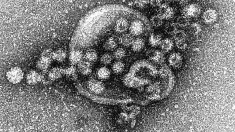 Norovirus       -  So sieht der Übeltäter aus: Noroviren unter einem Elektronenmikroskop