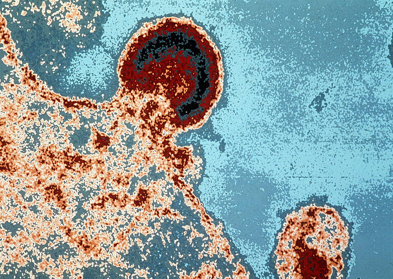 Eine Mikroskop-Aufnahme zeigt das HI-Virus. Foto: AFP, Institut Pasteur