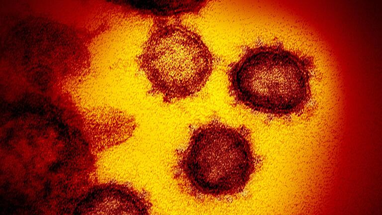 Diese Aufnahme mit einem Elektronenmikroskop zeigt das Coronavirus, das von einem Patienten in den USA isoliert wurde und aus der Oberfläche von im Labor kultivierten Zellen austritt. Die Omikron-Variante sorgt im Landkreis Haßberge aktuell für eine Inzidenz von 1419,2. Diese Aufnahme mit einem Elektronenmikroskop zeigt das Coronavirus, das von einem Patienten in den USA isoliert wurde und aus der Oberfläche von im Labor kultivierten Zellen austritt. Die Omikron-Variante sorgt im Landkreis Haßberge aktuell für eine Inzidenz von 1419,2.