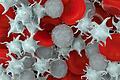red blood cells,activated platelet and white blood cells       -  Die Zellen unseres Blutes: Rote Blutkörperchen, weiße Blutkörperchen - und die Blutplättchen.