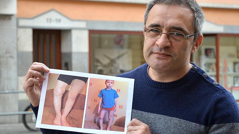 Konstantin Schmid hofft, genug Geld zusammenzubekommen, damit der fünfjährige Klim zur Operation nach Würzburg fliegen kann. Konstantin Schmid hofft, genug Geld zusammenzubekommen, damit der fünfjährige Klim zur Operation nach Würzburg fliegen kann.
