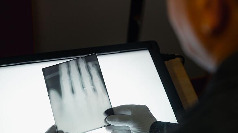 Röntgens Bilder       -  Ein Röntgenbild der Hand von Wilhelm Röntgen gehört nun zum  Unesco-Weltdokumentenerbe. (Archivbild)