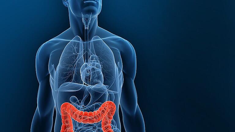 Wird er frühzeitig erkannt, ist Darmkrebs gut heilbar.