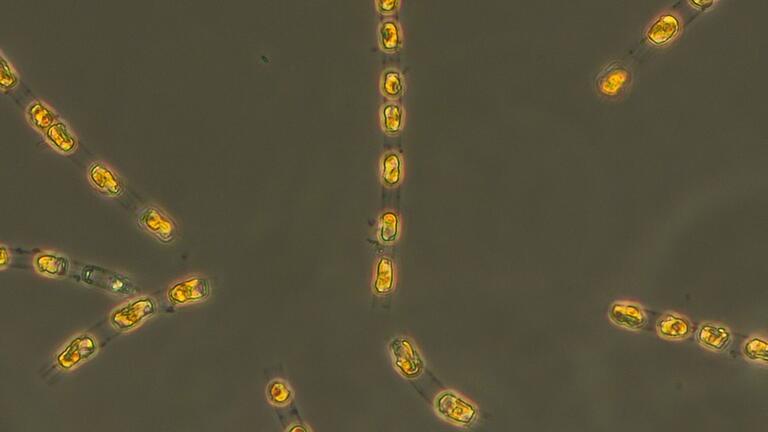 Kieselalge Skeletonema marinoi - Die Kieselalge Skeletonema marinoi ist nach 7000 Jahren in einem Dauerzustand auf dem Meeresgrund nun wieder aktiv. Kieselalge Skeletonema marinoi - Die Kieselalge Skeletonema marinoi ist nach 7000 Jahren in einem Dauerzustand auf dem Meeresgrund nun wieder aktiv.