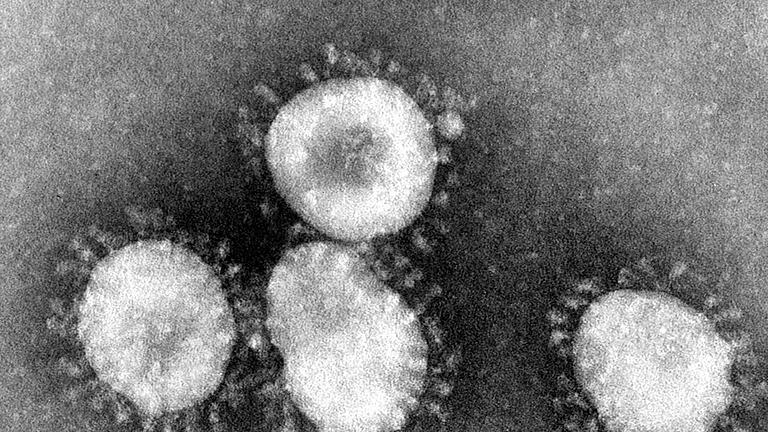 Coronavirus       -  Ein Coronavirus unter dem Mikroskop.