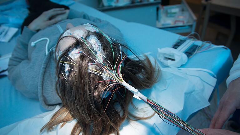 Elektroden zur Messung von Gehirnströmen - Eine Überaktivität des Gehirns, ganz plötzlich: Wer von Epilepsie betroffen ist, erlebt Anfälle oft aus heiterem Himmel. Elektroden zur Messung von Gehirnströmen - Eine Überaktivität des Gehirns, ganz plötzlich: Wer von Epilepsie betroffen ist, erlebt Anfälle oft aus heiterem Himmel.