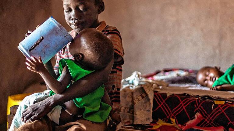 Viele Kinder unter fünf Jahren sterben an Unterernährung im Südsudan. Viele Kinder unter fünf Jahren sterben an Unterernährung im Südsudan.
