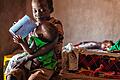 Viele Kinder unter fünf Jahren sterben an Unterernährung im Südsudan.