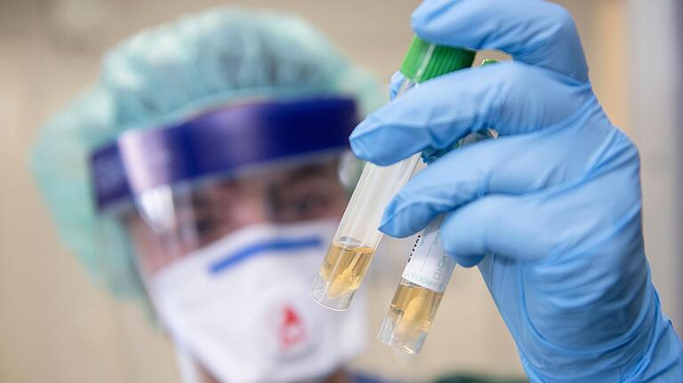 Eine Krankenschwester auf der Infektionsstation der Uniklinik Essen betrachtet in Schutzkleidung und mit einer Atemmaske zwei Abstrichröhrchen. Auch in Nordrhein-Westfalen hat sich erstmals ein Patient mit dem neuartigen Coronavirus infiziert. Eine Krankenschwester auf der Infektionsstation der Uniklinik Essen betrachtet in Schutzkleidung und mit einer Atemmaske zwei Abstrichröhrchen. Auch in Nordrhein-Westfalen hat sich erstmals ein Patient mit dem neuartigen Coronavirus infiziert.