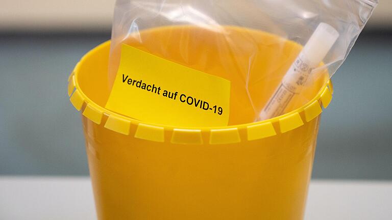 Wer sich mit dem Coronavirus infiziert hat, muss in Quarantäne. Aber auch für Kontaktpersonen der Kategorie I ist eine Quarantäne Pflicht. Wer sich mit dem Coronavirus infiziert hat, muss in Quarantäne. Aber auch für Kontaktpersonen der Kategorie I ist eine Quarantäne Pflicht.