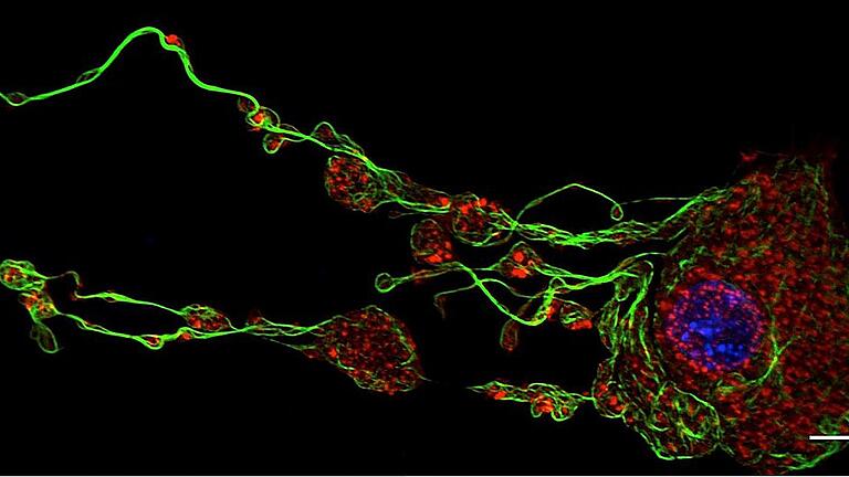 Blutplättchen entstehen im Knochenmark aus riesigen Voräuferzellen (Megakaryozyten). Gezeigt ist eine fluoreszenzmikroskopische Aufnahme eines Megakaryozyten, der gerade lange Ausläufer bildet, aus denen dann Blutplättchen freigesetzt werden. Diese sind bereits erkennbar als kugelförmige Ausstülpungen am Ende der Ausläufer.