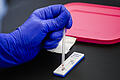 Coronavirus - Belgien       -  Eine Blutprobe wird auf einen Test für das Coronavirus gegeben (Symbolfoto)