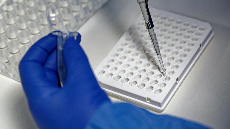Eine Mitarbeiterin eines Labors füllt mit einer Pipette zur Vorbereitung von Corona PCR-Tests eine Testflüssigkeit in einer Trägerplatte (Symbolbild). Die Sieben-Tage-Inzidenz in Rhön-Grabfeld ist zum Samstag etwas gesunken, zum Sonntag ging sie wieder stark nach oben. Eine Mitarbeiterin eines Labors füllt mit einer Pipette zur Vorbereitung von Corona PCR-Tests eine Testflüssigkeit in einer Trägerplatte (Symbolbild). Die Sieben-Tage-Inzidenz in Rhön-Grabfeld ist zum Samstag etwas gesunken, zum Sonntag ging sie wieder stark nach oben.