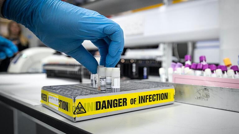 Drei Forscher nähren mit einer neuen Analyse die Theorie, dass Sars-CoV-2 aus einem Labor stammen könnte (Symbolbild). Experten kritisieren die Thesen scharf. Drei Forscher nähren mit einer neuen Analyse die Theorie, dass Sars-CoV-2 aus einem Labor stammen könnte (Symbolbild). Experten kritisieren die Thesen scharf.