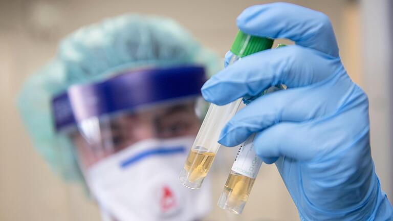 Eine Krankenschwester auf einer Infektionsstation betrachtet auf diesem Symbolbild in Schutzkleidung und mit einer Atemmaske zwei Abstrichröhrchen. Eine Krankenschwester auf einer Infektionsstation betrachtet auf diesem Symbolbild in Schutzkleidung und mit einer Atemmaske zwei Abstrichröhrchen.