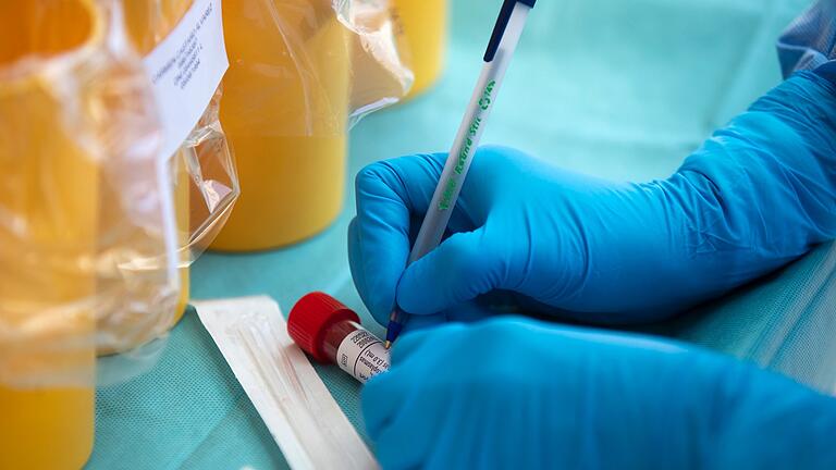 Wie verbreitete sich die Delta-Variante des Coronavirus bisher in Stadt und Landkreis Würzburg? Wie verbreitete sich die Delta-Variante des Coronavirus bisher in Stadt und Landkreis Würzburg?