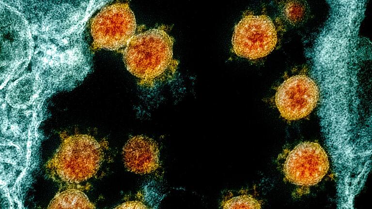 Coronavirus Partikel Sars-CoV-2       -  Elektronenmikroskopische Aufnahme mit Partikel des Coronavirus Sars-CoV-2, die von einem Patienten isoliert wurden (farblich bearbeitet, in Orange)