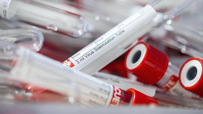 Es werden immer mehr, von der Dunkelziffer ganz zu schweigen:&nbsp; Bei fast 3900 Männern, Frauen und Kindern ist inzwischen das Coronavirus nachgewiesen worden.