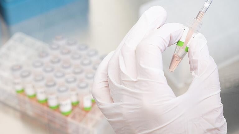 Coronavirus.jpeg       -  Die Zahl der laborbestätigten Coronainfektionen in Deutschland steigt.