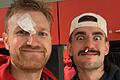 Maximilian Ugrai (links) und Zac Seljaas (rechts) nach dem Testspiel in Polen mit ihren Blessuren im Gesicht.