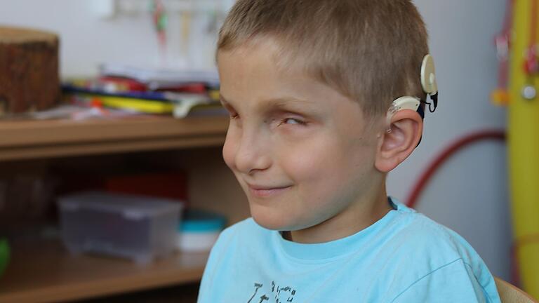 Am Hinterkopf von Lucas ist ein Cochlea-Implantat angebracht. Am Hinterkopf von Lucas ist ein Cochlea-Implantat angebracht.