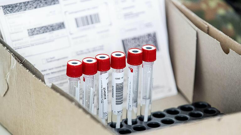 Proben für den PCR-Test warten auf den Transport ins Labor. In den letzten Wochen ist die Zahl der Neuinfektionen im Stadt und Landkreis Würzburg erheblich zurückgegangen.
