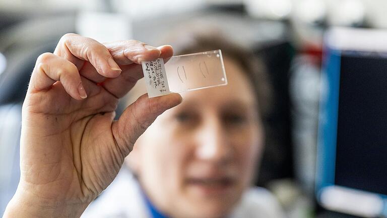 Die Biologin Dr. Sarah Nietzer zeigt die winzigen Querschnitt-Stücke eines fertigen Implantats, die für die Qualitätskontrolle eingefärbt und unter dem Mikroskop untersucht werden. Die Biologin Dr. Sarah Nietzer zeigt die winzigen Querschnitt-Stücke eines fertigen Implantats, die für die Qualitätskontrolle eingefärbt und unter dem Mikroskop untersucht werden.