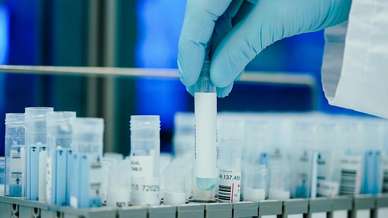 74 Neuinfektionen mit dem Coronavirus meldet das Gesundheitsamt am Dienstagnachmittag. 74 Neuinfektionen mit dem Coronavirus meldet das Gesundheitsamt am Dienstagnachmittag.
