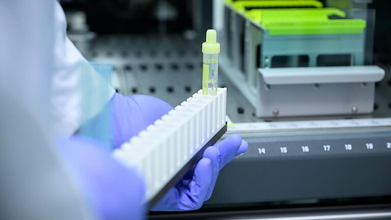 Ein Mitarbeiter der Biobank schiebt eine Probe in die sogenannte Pipettiermaschine, dort wird sie vollautomatisch auf kleine Röhrchen verteilt und mit Barcodes versehen. Ein Mitarbeiter der Biobank schiebt eine Probe in die sogenannte Pipettiermaschine, dort wird sie vollautomatisch auf kleine Röhrchen verteilt und mit Barcodes versehen.