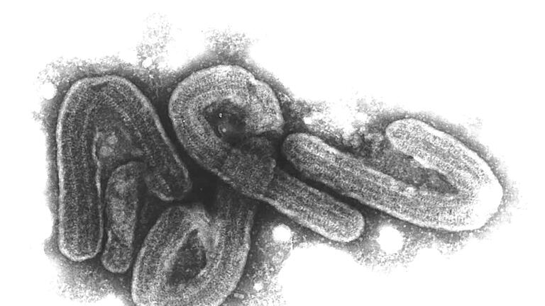 Marburg-Virus       -  Es bleibt beim einzigen Fall in Deutschland im Jahr 1967.