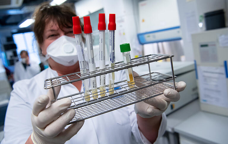 Überall auf der Welt erforschen Wissenschaftler und Ärzte das Coronavirus. Überall auf der Welt erforschen Wissenschaftler und Ärzte das Coronavirus.