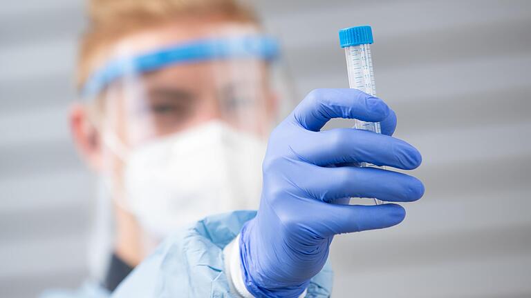 Die vorgesehenen ein bis zwei Tage zwischen Corona-Test und dem Vorliegen des Ergebnisses können nicht immer eingehalten werden. Die vorgesehenen ein bis zwei Tage zwischen Corona-Test und dem Vorliegen des Ergebnisses können nicht immer eingehalten werden.