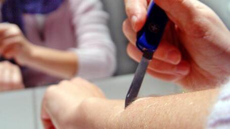 Ritzen und Schneiden - Selbstverletzungen sind Hilfeschreie       -  Ventil für die Seele &ndash; Betroffene verletzen sich oft selbst, weil sie darüber ihre Probleme für kurze Zeit vergessen können.