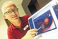 Er rettet Leben: Fast täglich entdeckt Internist und Gastroenterologe Dr. Thomas Brohm bei Darmspiegelungen Mutationen wie diesen Stiel-Polypen. Mittels moderner Technik kann er das krankhafte Gewebe sofort entfernen &ndash; und damit das Darmkrebsrisiko enorm senken.