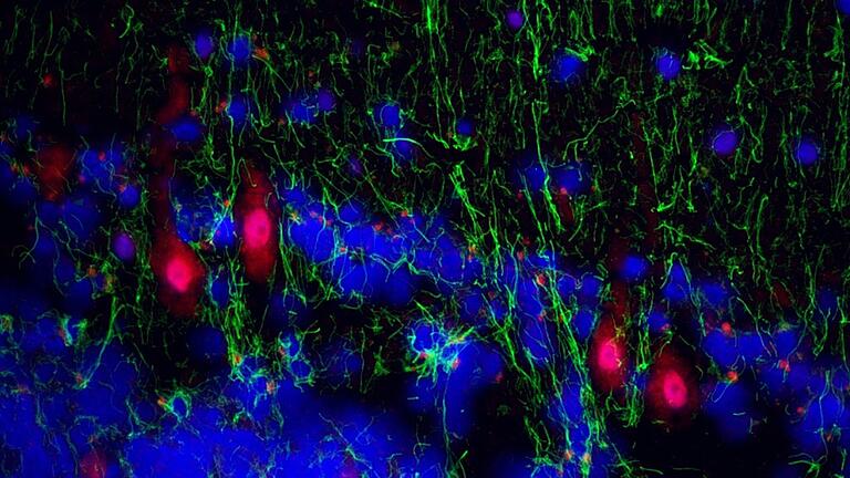 Als sei es Kunst: Immunfluoreszenzaufnahme aus der Kleinhirnrindenregion von bipolaren Patienten, die Proteine von humanen Herpesviren (rot gefärbt) in bestimmten Nervenzellen zeigen.