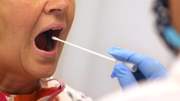 Seit 1. Juli kann sich laut Staatsregierung jeder Einwohner Bayerns kostenlos auf das Coronavirus&nbsp; (Symbolbild) testen lassen – auch ohne Symptome. Klappt das in den Praxen in Unterfranken?
