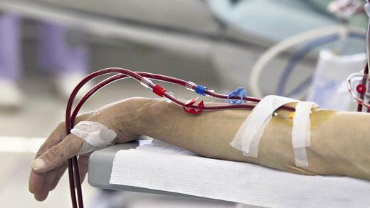 Wenn die Nieren versagen: 8400 Frauen und Männer warten in Deutschland auf eine Spenderniere. Bis zur Transplantation sind sie auf die Dialyse angewiesen. Wenn die Nieren versagen: 8400 Frauen und Männer warten in Deutschland auf eine Spenderniere. Bis zur Transplantation sind sie auf die Dialyse angewiesen.