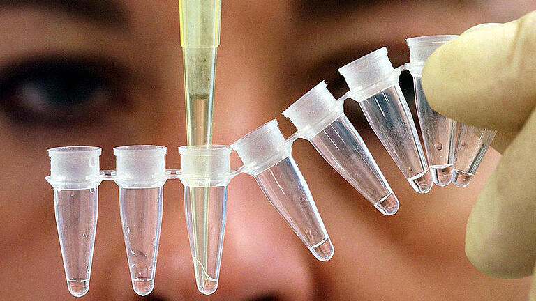Vaterschaftstest im Genlabor       -  Vaterschaftstest im Genlabor: Das Bundesverfassungsgericht hat entschieden, dass eine Frau einen Mann, den sie für ihren Vater hält, nicht zum DNA-Test zwingen kann. Foto: Boris Roessler/Illustration