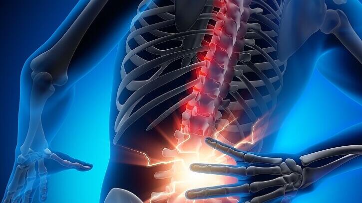 Rückenschmerz 2       -  Lendenwirbel-Schmerzen können „die Hölle“ sein.