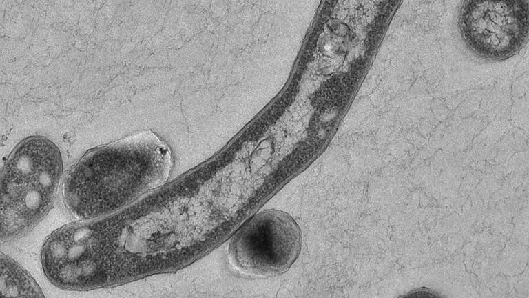 Der Tuberkulose-Erreger Mycobacterium tuberculosis, aufgenommen unter dem Elektronenmikroskop.&nbsp;