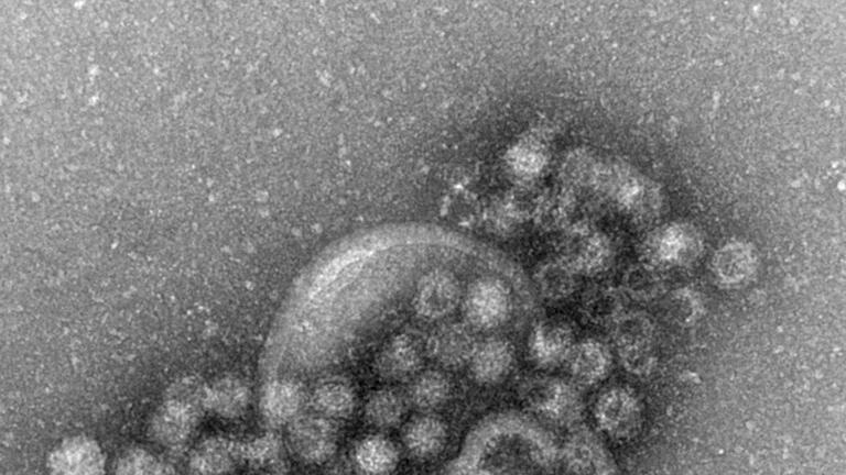 Norovirus       -  Das hochansteckende Norovirus verursacht einen plötzlich auftretenden, heftigen Brechdurchfall.