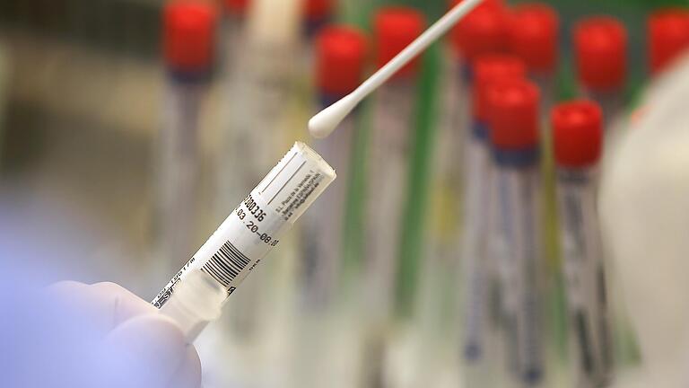 Im Landkreis Haßberge hat der 7-Tage-Inzidenzwert inzwischen beinahe die 160 erreicht. 137 Neuinfizierte kamen seit vergangenen Freitag hinzu. Insgesamt hat das Gesundheitsamt nun 601 Corona-Fälle registriert. Im Landkreis Haßberge hat der 7-Tage-Inzidenzwert inzwischen beinahe die 160 erreicht. 137 Neuinfizierte kamen seit vergangenen Freitag hinzu. Insgesamt hat das Gesundheitsamt nun 601 Corona-Fälle registriert.