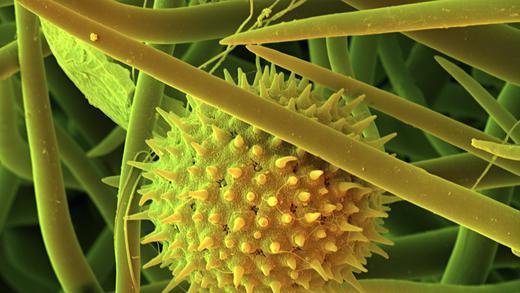 Stefan Dillers Bilder       -  Seit vielen Jahren beschäftigt sich der Würzburger Wissenschaftsfotograf Stefan Diller mit den Möglichkeiten der Elektronenmikroskopie und taucht mit ihr in die Wunderwelt des Allerkleinsten ein.  Hier: Eibisch.