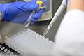 Eine Labormitarbeiterin bereitet PCR-Tests vor. Immer wird dabei auch der so genannte CT-Wert ermittelt, er gilt als Richtwert für die Corona-Infektiosität von Betroffenen.