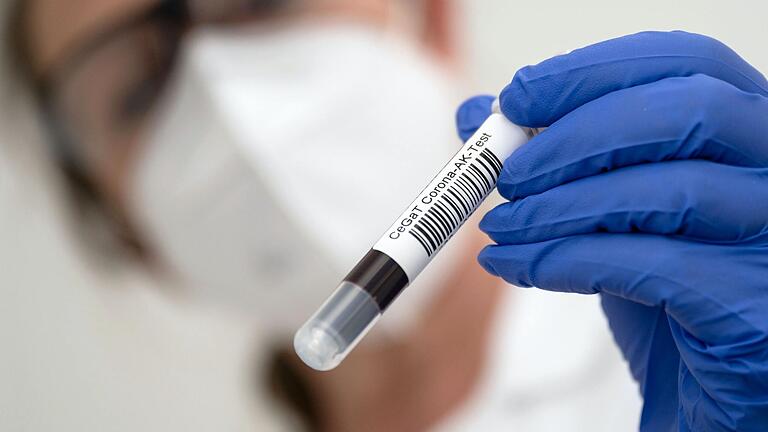 Die Mitarbeiterin eines Labors hält auf diesem Symbolbild ein Blutentahmeröhrchen mit Blut für einen Corona-Antikörper-Test in der Hand. Über 240 Mal ist bislang im Landkreis Haßberge der Test seit Ausbruch der Pandemie positiv ausgefallen. Die Mitarbeiterin eines Labors hält auf diesem Symbolbild ein Blutentahmeröhrchen mit Blut für einen Corona-Antikörper-Test in der Hand. Über 240 Mal ist bislang im Landkreis Haßberge der Test seit Ausbruch der Pandemie positiv ausgefallen.
