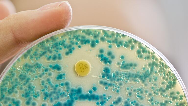 Antibiotikaresistente Keime       -  Indikatorkulturplatte zum Nachweis von resistenten Bakterien: Antibiotikaresistente Keime verursachen allein in der EU jährlich Zehntausende Todesfälle. (Symbolbild)