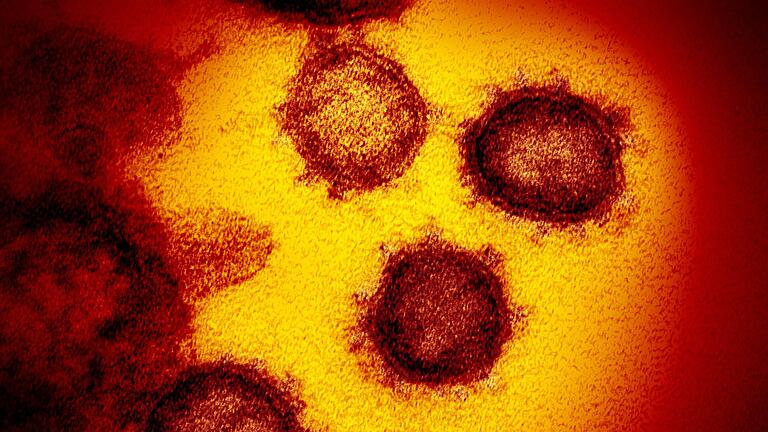 Die Elektronenmikroskopaufnahme zeigt ein isoliertes Coronavirus, das aus der Oberfläche von im Labor kultivierten Zellen austritt. Die Elektronenmikroskopaufnahme zeigt ein isoliertes Coronavirus, das aus der Oberfläche von im Labor kultivierten Zellen austritt.