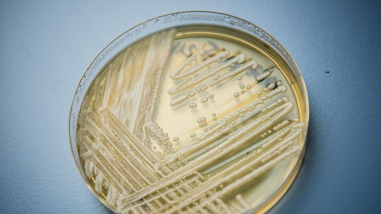 Pilzerreger Candida auris       -  Der Hefepilz Candida auris breitet sich in Deutschland aus.