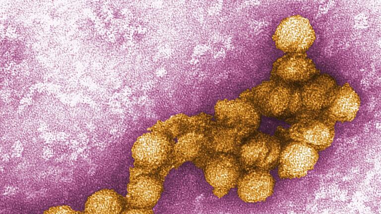 West-Nil-Virus       -  In diesem Jahr könnte es besonders viele Infektionen mit dem Erreger in Deutschland geben. (Archivbild)